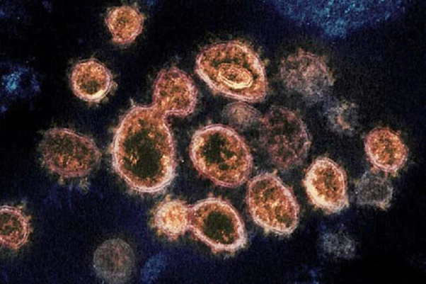 Langya henipavirus